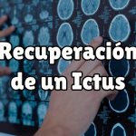 ¿Cómo recuperarse de un Ictus?