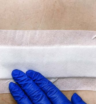 Cómo curar escaras en personas mayores 2 como curar escaras en personas mayores