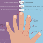 diferencias entre artritis y artrosis