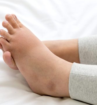 pies hinchados en personas mayores causas y consejos