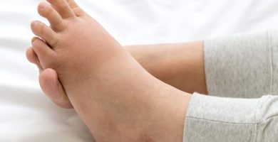 pies hinchados en personas mayores causas y consejos